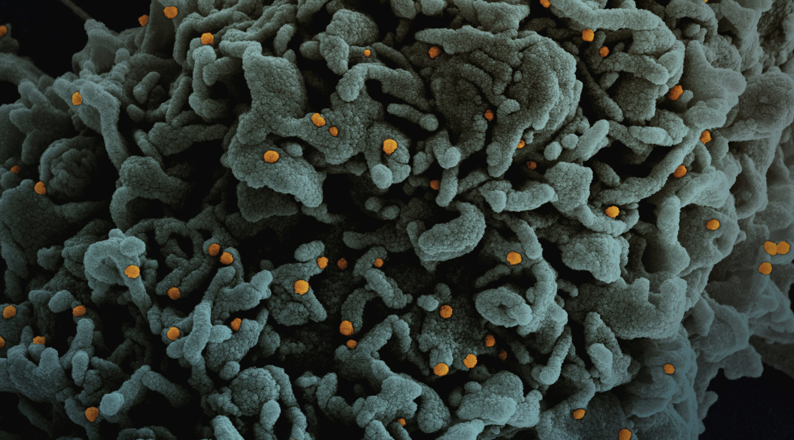 Extreme close up of a virus cell computer generated with fine details